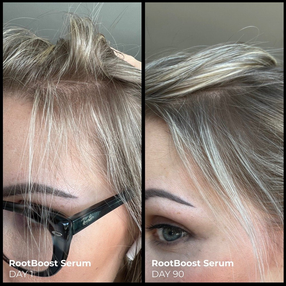 Better Roots RootBoost Serum